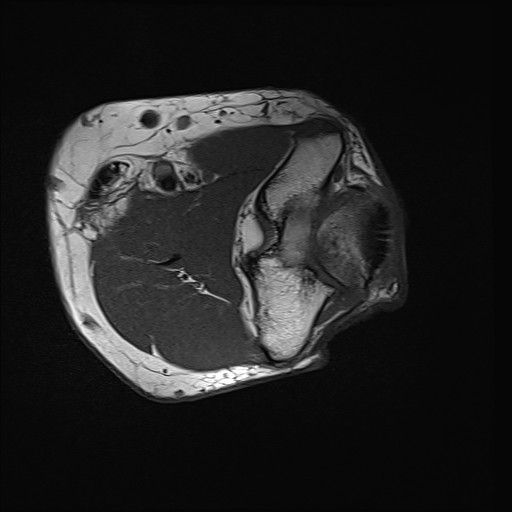 Click on the Serie image to view the images of Wieszt, Gnter